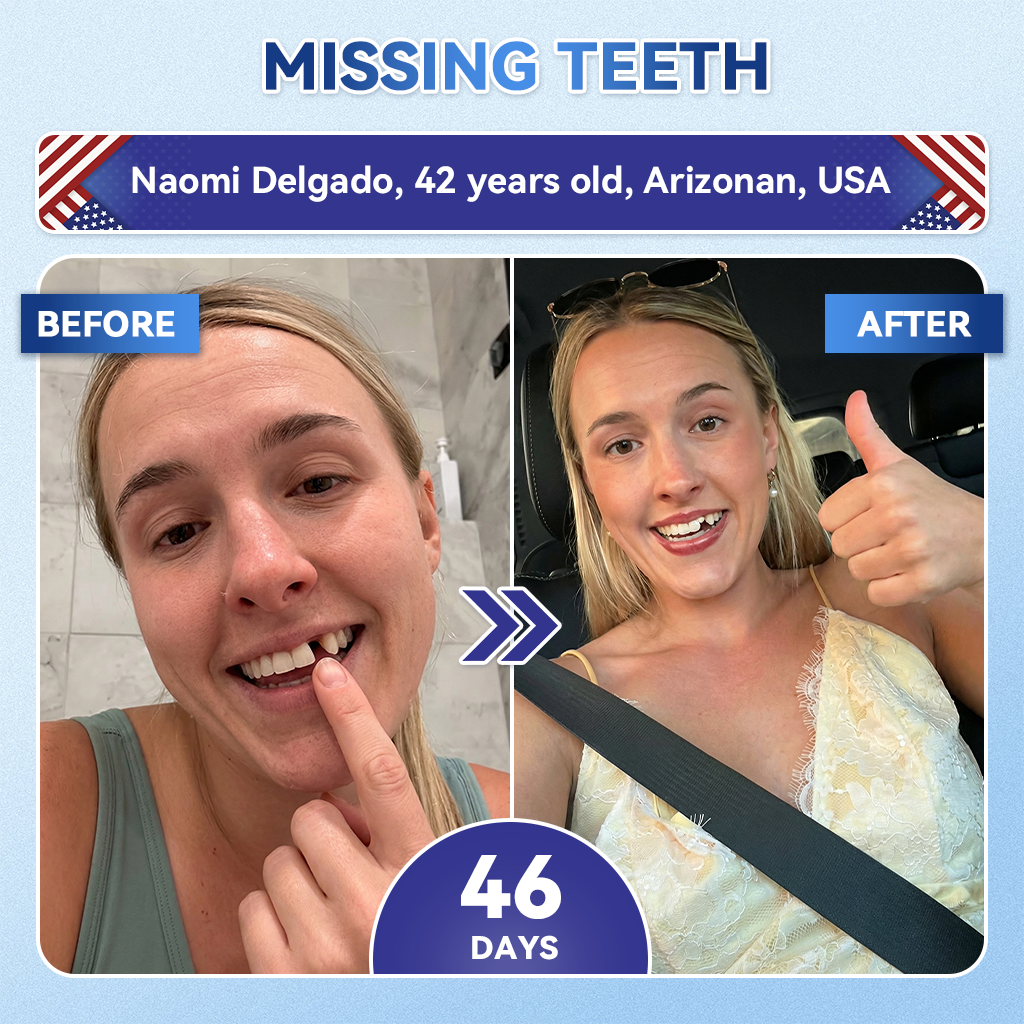 Your Smile~ Natravorยฎ ๐ฆท Tideglusib FastโDissolving Tooth & Gum Repair Oral Strips โจ (๐-๐ข๐ง-๐ ๐ ๐๐๐๐ฎ๐ข๐ฅ๐ ๐๐ง๐๐ฆ๐๐ฅ & ๐๐๐ง๐ญ๐ข๐ง โข ๐๐ญ๐ซ๐๐ง๐ ๐ญ๐ก๐๐ง ๐๐ฎ๐ฆ๐ฌ โข ๐๐ซ๐๐๐ข๐๐๐ญ๐ ๐๐๐ซ๐ญ๐๐ซ & ๐๐๐จ๐ซ โข ๐๐ก๐ข๐ญ๐๐ง๐ข๐ง๐ โข ๐๐ญ๐จ๐ฉ ๐๐จ๐จ๐ญ๐ก ๐๐๐ง๐ฌ๐ข๐ญ๐ข๐ฏ๐ข๐ญ๐ฒ)๐ฆท