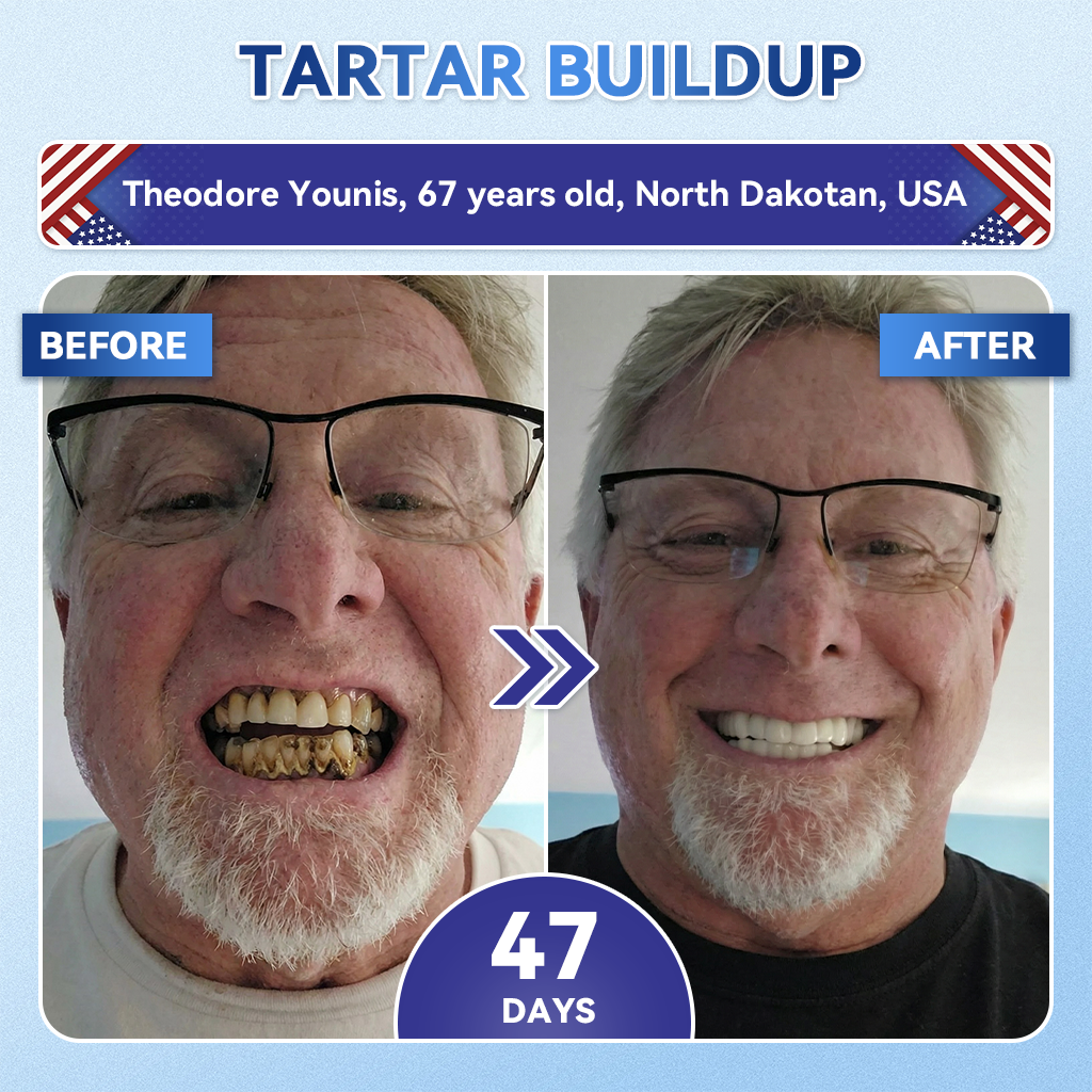 Your Smile~ Natravor® 🦷 Tideglusib Fast‑Dissolving Tooth & Gum Repair Oral Strips ✨ (𝟓-𝐢𝐧-𝟏 💎 𝐑𝐞𝐛𝐮𝐢𝐥𝐝 𝐄𝐧𝐚𝐦𝐞𝐥 & 𝐃𝐞𝐧𝐭𝐢𝐧 • 𝐒𝐭𝐫𝐞𝐧𝐠𝐭𝐡𝐞𝐧 𝐆𝐮𝐦𝐬 • 𝐄𝐫𝐚𝐝𝐢𝐜𝐚𝐭𝐞 𝐓𝐚𝐫𝐭𝐚𝐫 & 𝐎𝐝𝐨𝐫 • 𝐖𝐡𝐢𝐭𝐞𝐧𝐢𝐧𝐠 • 𝐒𝐭𝐨𝐩 𝐓𝐨𝐨𝐭𝐡 𝐒𝐞𝐧𝐬𝐢𝐭𝐢𝐯𝐢𝐭𝐲)🦷