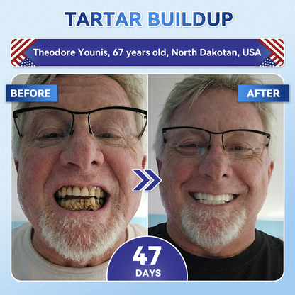 Your Smile~ Natravor® 🦷 Tideglusib Fast‑Dissolving Tooth & Gum Repair Oral Strips ✨ (𝟓-𝐢𝐧-𝟏 💎 𝐑𝐞𝐛𝐮𝐢𝐥𝐝 𝐄𝐧𝐚𝐦𝐞𝐥 & 𝐃𝐞𝐧𝐭𝐢𝐧 • 𝐒𝐭𝐫𝐞𝐧𝐠𝐭𝐡𝐞𝐧 𝐆𝐮𝐦𝐬 • 𝐄𝐫𝐚𝐝𝐢𝐜𝐚𝐭𝐞 𝐓𝐚𝐫𝐭𝐚𝐫 & 𝐎𝐝𝐨𝐫 • 𝐖𝐡𝐢𝐭𝐞𝐧𝐢𝐧𝐠 • 𝐒𝐭𝐨𝐩 𝐓𝐨𝐨𝐭𝐡 𝐒𝐞𝐧𝐬𝐢𝐭𝐢𝐯𝐢𝐭𝐲)🦷
