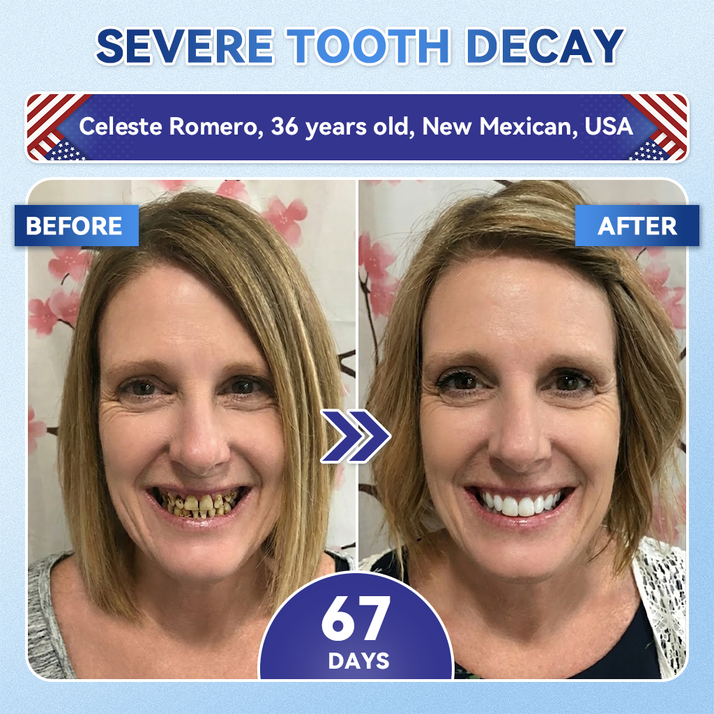 Your Smile~ Natravor® 🦷 Tideglusib Fast‑Dissolving Tooth & Gum Repair Oral Strips ✨ (𝟓-𝐢𝐧-𝟏 💎 𝐑𝐞𝐛𝐮𝐢𝐥𝐝 𝐄𝐧𝐚𝐦𝐞𝐥 & 𝐃𝐞𝐧𝐭𝐢𝐧 • 𝐒𝐭𝐫𝐞𝐧𝐠𝐭𝐡𝐞𝐧 𝐆𝐮𝐦𝐬 • 𝐄𝐫𝐚𝐝𝐢𝐜𝐚𝐭𝐞 𝐓𝐚𝐫𝐭𝐚𝐫 & 𝐎𝐝𝐨𝐫 • 𝐖𝐡𝐢𝐭𝐞𝐧𝐢𝐧𝐠 • 𝐒𝐭𝐨𝐩 𝐓𝐨𝐨𝐭𝐡 𝐒𝐞𝐧𝐬𝐢𝐭𝐢𝐯𝐢𝐭𝐲)🦷