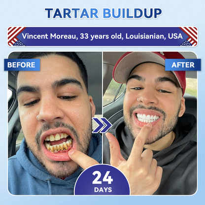 Your Smile~ Natravor® 🦷 Tideglusib Fast‑Dissolving Tooth & Gum Repair Oral Strips ✨ (𝟓-𝐢𝐧-𝟏 💎 𝐑𝐞𝐛𝐮𝐢𝐥𝐝 𝐄𝐧𝐚𝐦𝐞𝐥 & 𝐃𝐞𝐧𝐭𝐢𝐧 • 𝐒𝐭𝐫𝐞𝐧𝐠𝐭𝐡𝐞𝐧 𝐆𝐮𝐦𝐬 • 𝐄𝐫𝐚𝐝𝐢𝐜𝐚𝐭𝐞 𝐓𝐚𝐫𝐭𝐚𝐫 & 𝐎𝐝𝐨𝐫 • 𝐖𝐡𝐢𝐭𝐞𝐧𝐢𝐧𝐠 • 𝐒𝐭𝐨𝐩 𝐓𝐨𝐨𝐭𝐡 𝐒𝐞𝐧𝐬𝐢𝐭𝐢𝐯𝐢𝐭𝐲)🦷