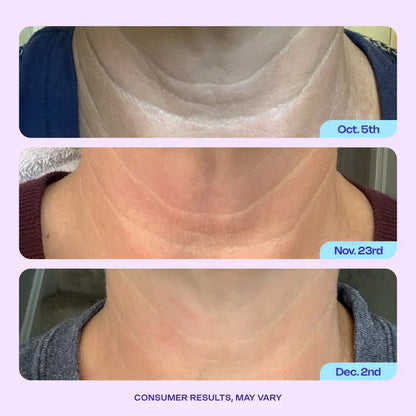 VURIEXO Miracle Neck Cream: Erase "Turkey Neck" & "Tech Neck" Lines Visible Lift & Smoothness in 4 Weeks