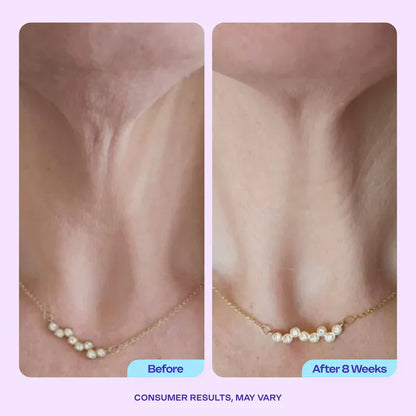 VURIEXO Miracle Neck Cream: Erase "Turkey Neck" & "Tech Neck" Lines Visible Lift & Smoothness in 4 Weeks